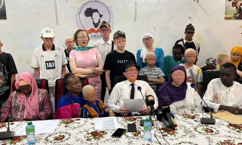 Société : Sous le soleil de Kaolack, les personnes atteintes d’albinisme réclament plus de protection